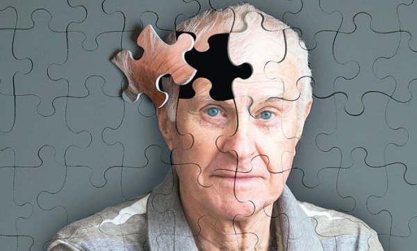 알츠하이머의 5가지 징후