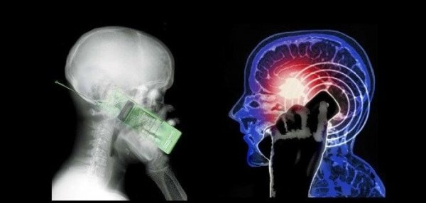 전자 기기는 뇌에 어떤 영향을 미칠까?