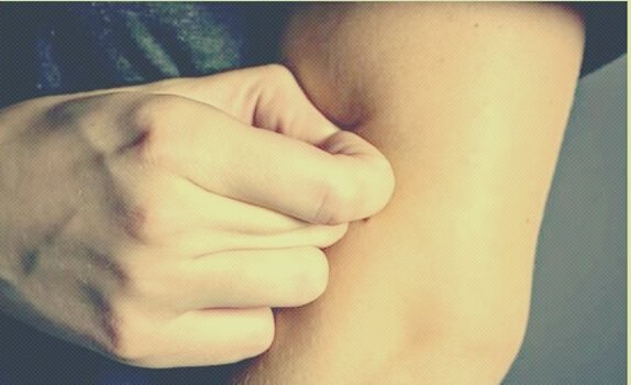 피부 벗기기 장애