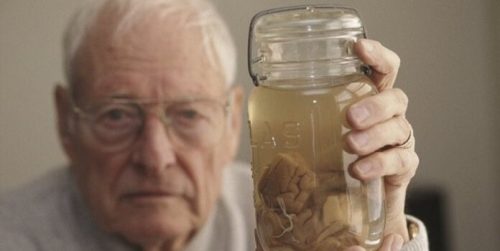 아인슈타인의 뇌는 보통 사람의 뇌보다 작았다