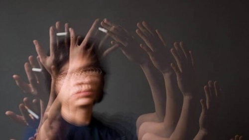 친숙한 대상을 알아보지 못하는 실인증 01