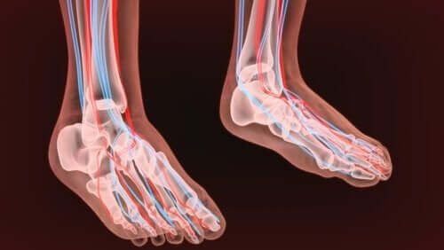 말초신경병증 - 두 발의 뼈
