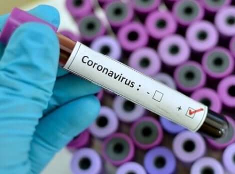 코로나바이러스에 대한 세 가지 심리적 조언