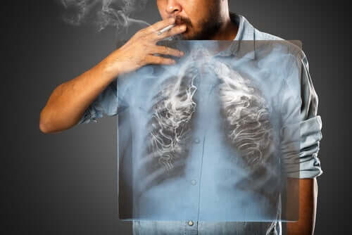 흡연은 COVID-19 합병증의 위험을 증가시킬까?