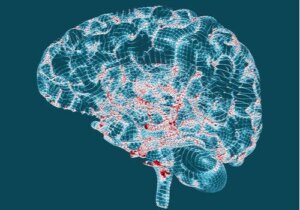 헌팅턴병의 특성과 징후