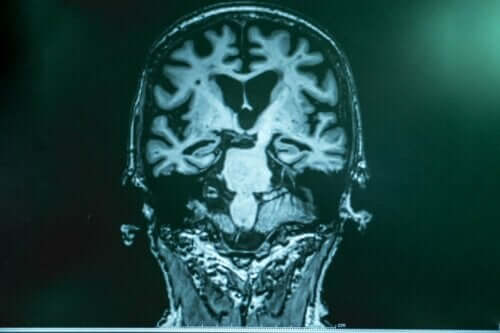 뇌파 자극에 관한 추가 연구